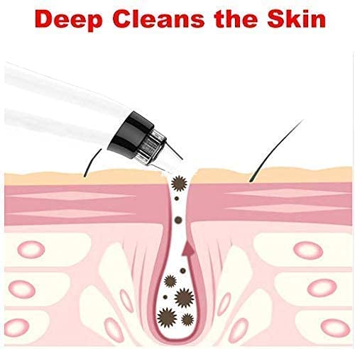 WYNXCARE Blackhead Remover Tool | Silicone Blackheads Removal Suction Machine, Replaces Nose Strips | Pimple Acne Pore Remover Tool, 4 In 1 Multi-Function Remove Blackheads For Men & Women